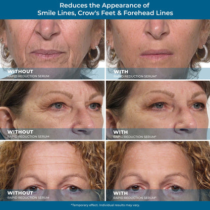 Plexaderm Rapid Reduction Eye Serum cosmetic product image 6